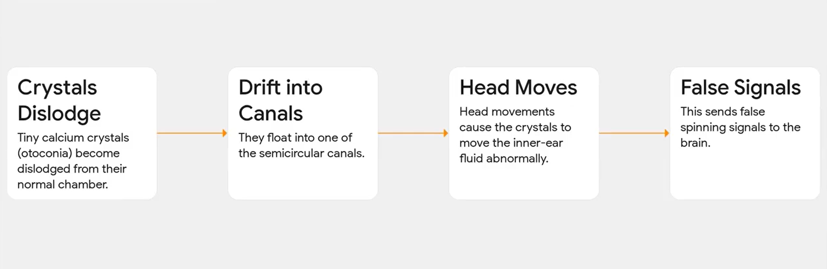 Step-by-step diagram showing how dislodged calcium crystals (otoconia) drift into semicircular canals, move with head motion, and send false spinning signals to the brain.