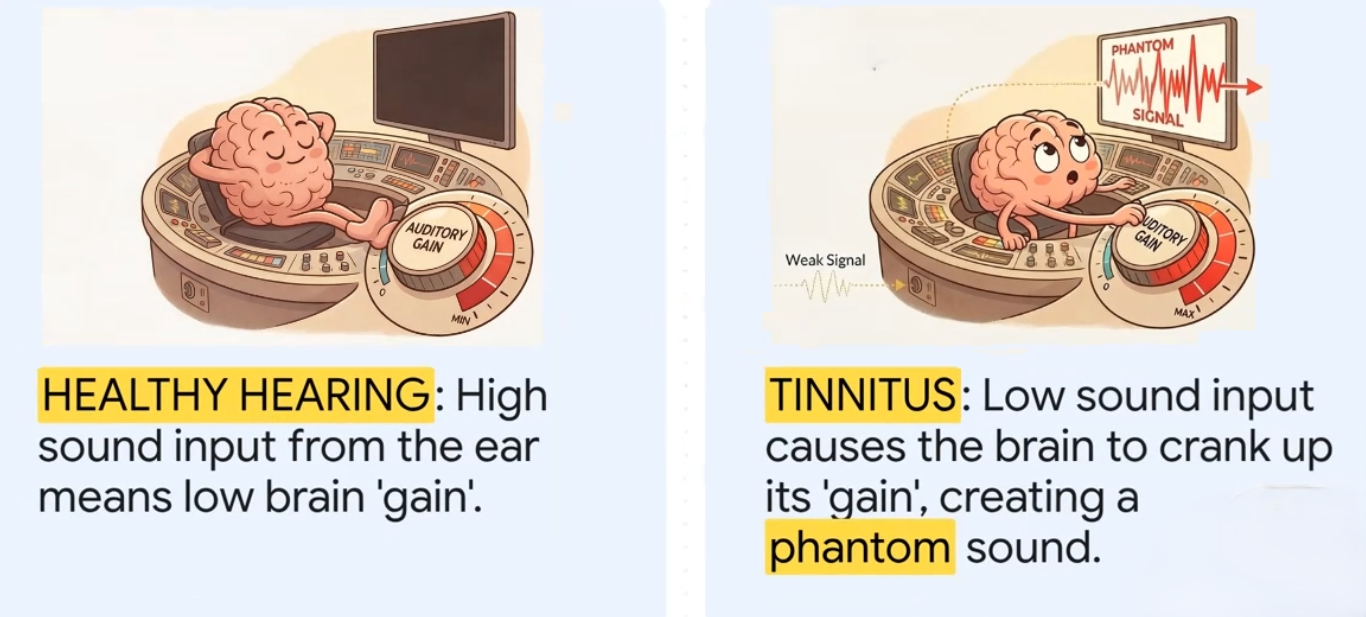 Tinnitus Phantom Tinnitus Symptoms photo